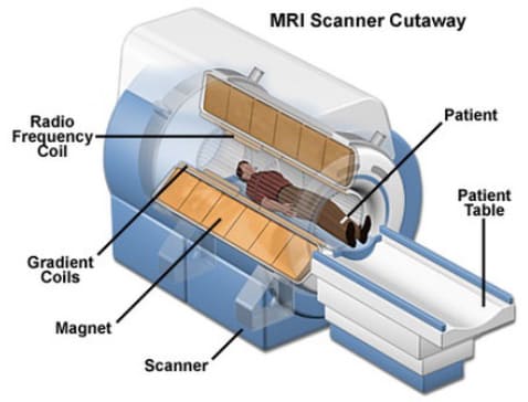 4 mri machine thermal management with aluminum nitride